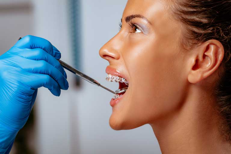 Woman having her braces checked at the dentist